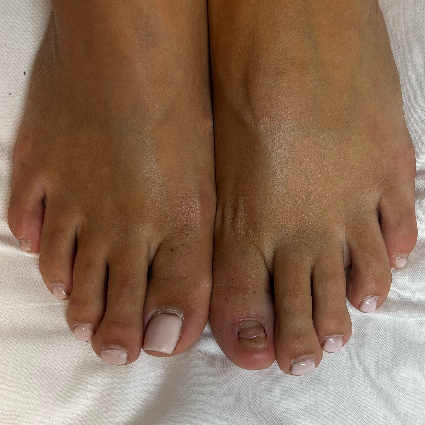 Shellac fødder inkl aftagning + rep af tånegl med gele